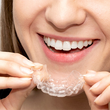 /clear aligners